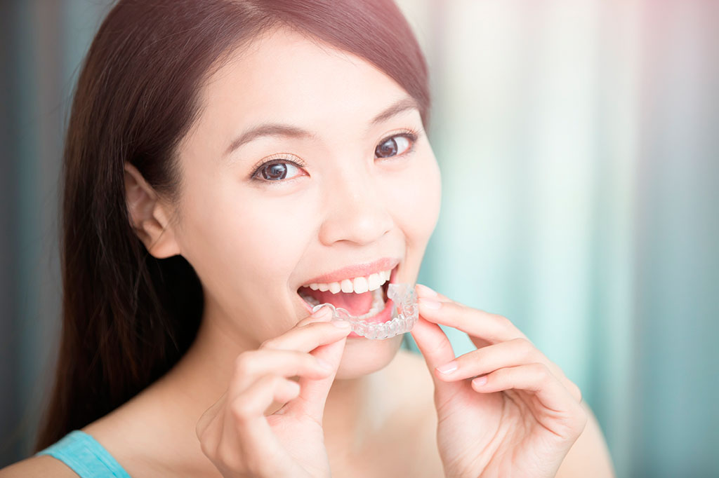 Young woman putting in her Invisalign aligners